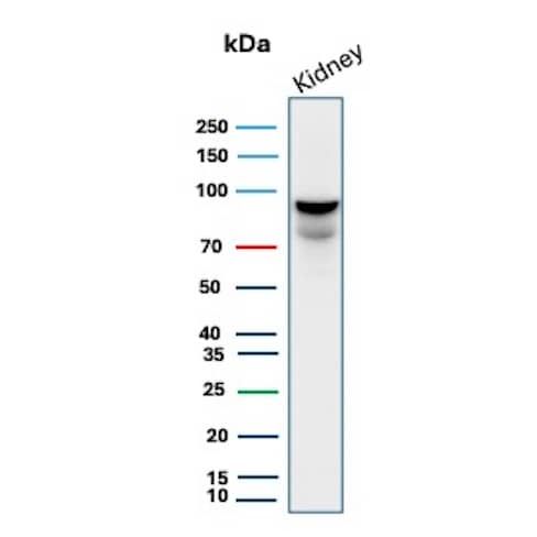MICA Antibody (MICA/4443) Western Blot: MICA Antibody (MICA/4443) [NBP3-13827] -