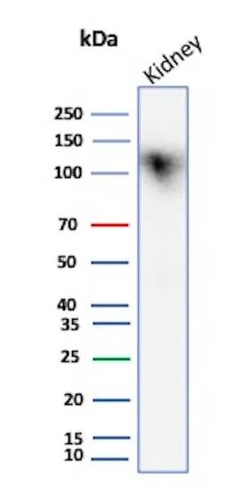 Cadherin-16 Antibody (CDH16/7027R) Western Blot: Cadherin-16 Antibody (CDH16/7027R) [NBP3-13828] -