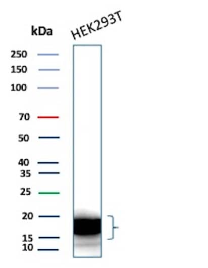 p16INK4a/CDKN2A Antibody (CDKN2A/7081R) Western Blot: p16INK4a/CDKN2A Antibody (CDKN2A/7081R) [NBP3-13834] -