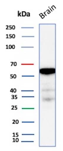 Aldehyde Dehydrogenase 1-A1/ALDH1A1 Antibody (ALDH1A1/7011R) Western Blot: Aldehyde Dehydrogenase 1-A1/ALDH1A1 Antibody (ALDH1A1/7011R) [NBP3-13880] -