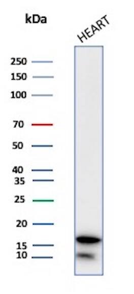 FABP3/H-FABP Antibody (FABP3/3430) Western Blot: FABP3/H-FABP Antibody (FABP3/3430) [NBP3-13881] -