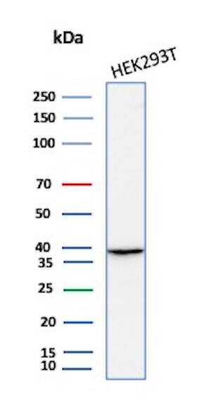 AKR1B1 Antibody (rAKR1B1/7295) Western Blot: AKR1B1 Antibody (rAKR1B1/7295) [NBP3-13895] -