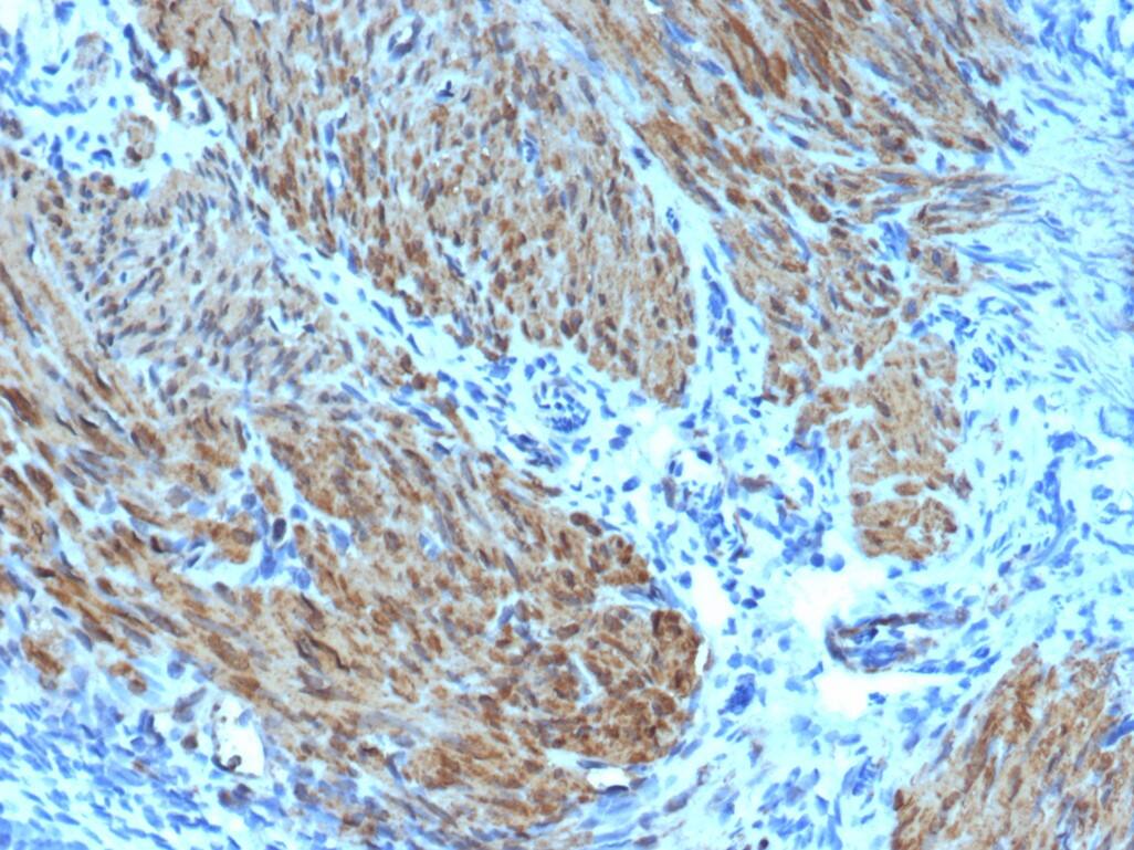 Actin (Muscle Specific) Antibody (rMSA/953) Actin (Muscle Specific) Antibody (rMSA/953)