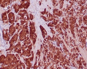 Isocitrate Dehydrogenase 1/IDH1 Antibody (IDH1/6806R)