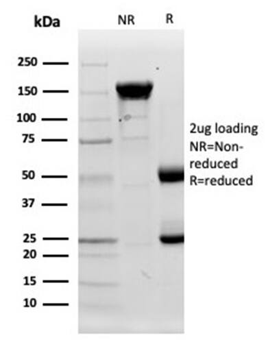 Lysozyme Antibody (LYZ/3944) Protein Array: Lysozyme Antibody (LYZ/3944) [NBP3-13962] -