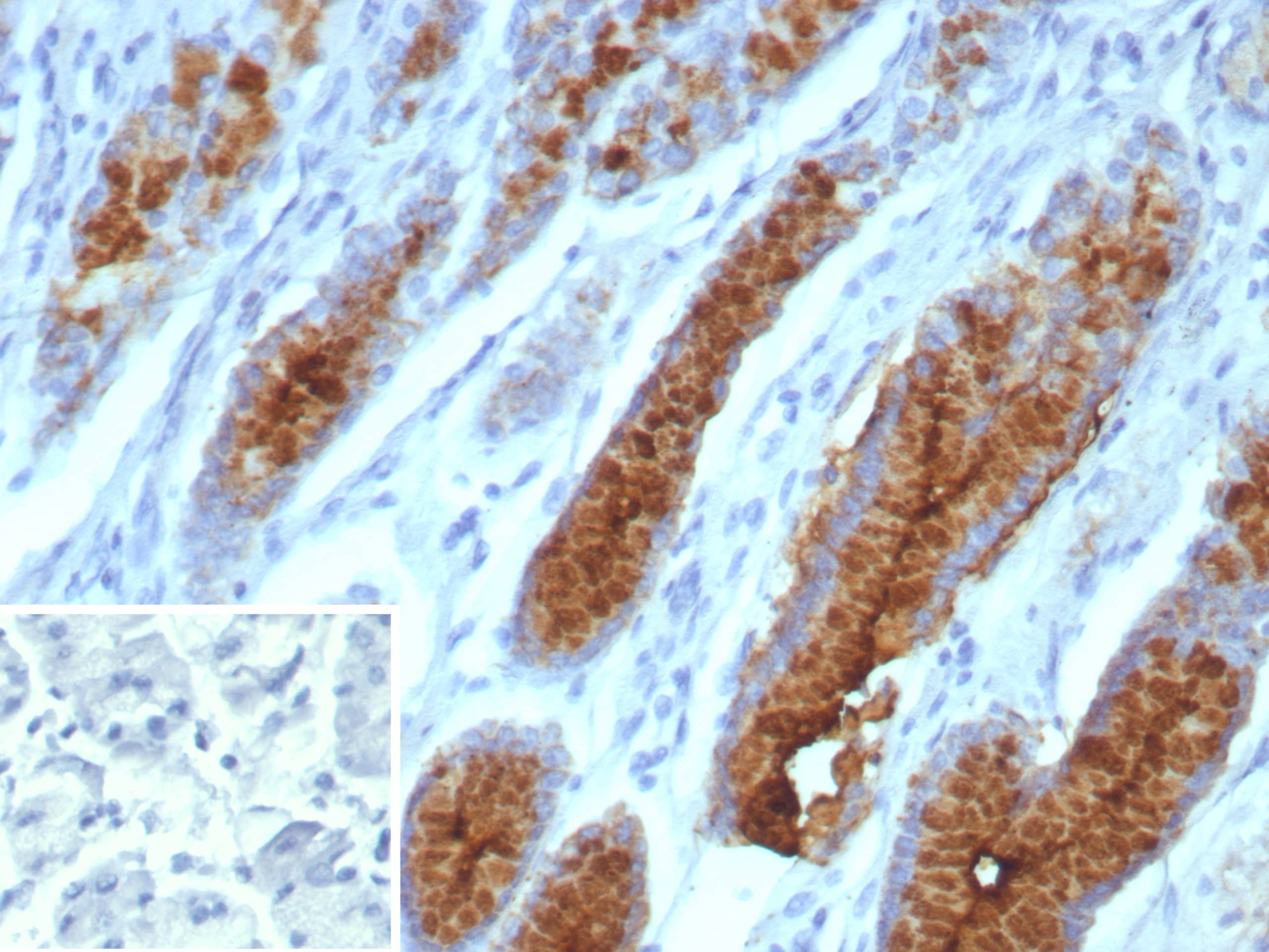 MUC5AC Antibody (MUC5AC/7066R) Immunohistochemistry-Paraffin: MUC5AC Antibody (MUC5AC/7066R) [NBP3-13974] -