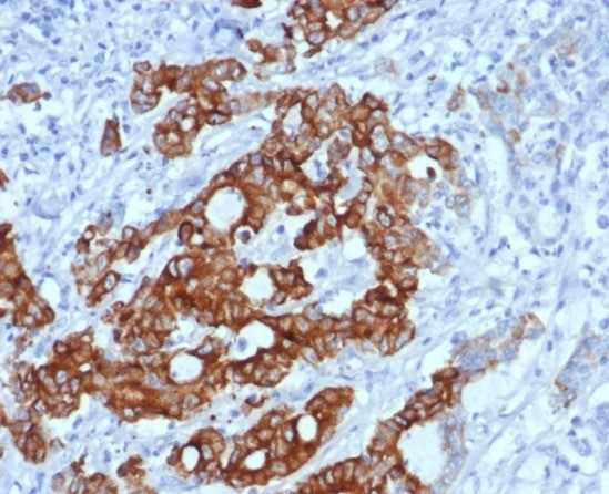 MUC6 Antibody (MUC6/7069R)