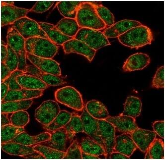 ATF2 Antibody (PCRP-ATF2-1B4) - Azide and BSA Free Immunocytochemistry/ Immunofluorescence: ATF2 Antibody (PCRP-ATF2-1B4) - Azide and BSA Free [NBP3-14001] -
