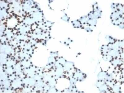 Ku80/XRCC5 Antibody (XRCC5/7315) - Azide and BSA Free Immunohistochemistry-Paraffin: Ku80/XRCC5 Antibody (XRCC5/7315) - Azide and BSA Free [NBP3-14017] -
