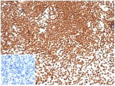 NPM1 Antibody (NPM1/7072R) - Azide and BSA Free Immunohistochemistry-Paraffin: NPM1 Antibody (NPM1/7072R) - Azide and BSA Free [NBP3-14019] -
