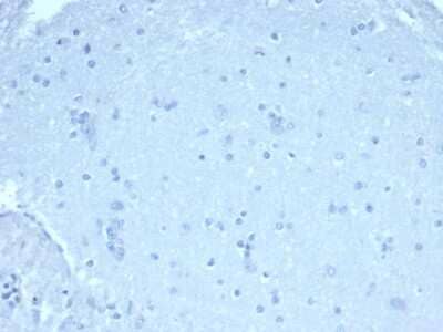 FoxP1 Antibody (rFOXP1/6902) - Azide and BSA Free Immunohistochemistry-Paraffin: FoxP1 Antibody (rFOXP1/6902) - Azide and BSA Free [NBP3-14022] -