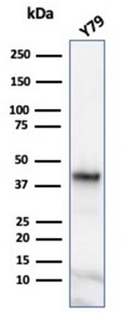 Glutamine Synthetase Antibody (GLUL/6600) - Azide and BSA Free Western Blot: Glutamine Synthetase Antibody (GLUL/6600) - Azide and BSA Free [NBP3-14023] -