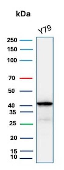 Glutamine Synthetase Antibody (GLUL/6600) - Azide and BSA Free Western Blot: Glutamine Synthetase Antibody (GLUL/6600) - Azide and BSA Free [NBP3-14023] -