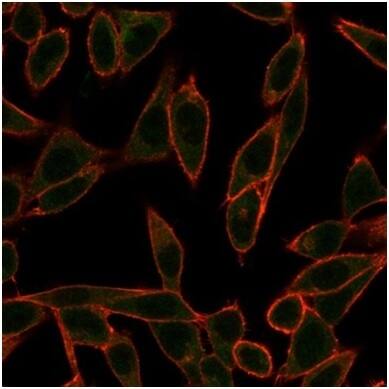 Neurogenin-3 Antibody (PCRP-NEUROG3-1E10) - Azide and BSA Free Immunocytochemistry/ Immunofluorescence: Neurogenin-3 Antibody (PCRP-NEUROG3-1E10) - Azide and BSA Free [NBP3-14029] -