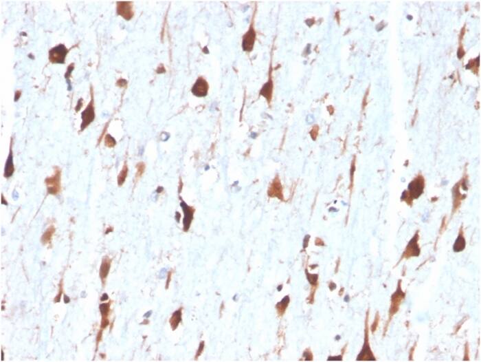Carbonic Anhydrase VIII/CA8 Antibody (CA8/6572) - Azide and BSA Free Immunohistochemistry-Paraffin: Carbonic Anhydrase VIII/CA8 Antibody (CA8/6572) - Azide and BSA Free [NBP3-14030] -