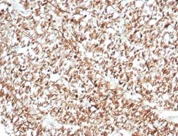 Calretinin Antibody (CALB2/7029R) - Azide and BSA Free
