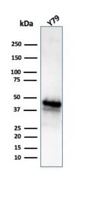 Glutamine Synthetase Antibody (GLUL/6604) - Azide and BSA Free Western Blot: Glutamine Synthetase Antibody (GLUL/6604) - Azide and BSA Free [NBP3-14039] -