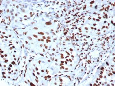 HIST1H3A [p Ser10] Antibody (rPHH3/6824) - Azide and BSA Free Immunohistochemistry-Paraffin: HIST1H3A [p Ser10] Antibody (rPHH3/6824) - Azide and BSA Free [NBP3-14043] -