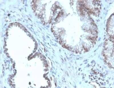 SLC45A3/Prostein Antibody (SLC45A3/4965R) - Azide and BSA Free Immunohistochemistry-Paraffin: SLC45A3/Prostein Antibody (SLC45A3/4965R) - Azide and BSA Free [NBP3-14048] -