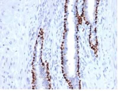 p40/deltaNp63 Antibody (P40/4396R) - Azide and BSA Free Immunohistochemistry-Paraffin: p40/deltaNp63 Antibody (P40/4396R) - Azide and BSA Free [NBP3-14050] -