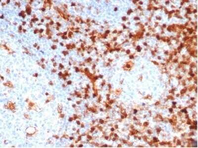 Annexin A1 Antibody (ANXA1/6452R) - Azide and BSA Free Immunohistochemistry-Paraffin: Annexin A1 Antibody (ANXA1/6452R) - Azide and BSA Free [NBP3-14056] -