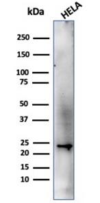 CBFB Antibody (PCRP-CBFB-1F6) - Azide and BSA Free Western Blot: CBFB Antibody (PCRP-CBFB-1F6) - Azide and BSA Free [NBP3-14058] -