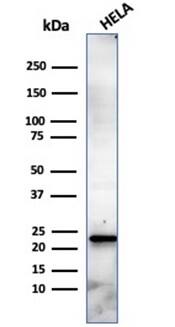 CBFB Antibody (PCRP-CBFB-1E6) - Azide and BSA Free Western Blot: CBFB Antibody (PCRP-CBFB-1E6) - Azide and BSA Free [NBP3-14059] -
