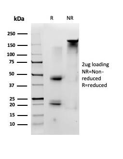 ID1 Antibody (PCRP-ID1-2F11) - Azide and BSA Free Immunocytochemistry/ Immunofluorescence: ID1 Antibody (PCRP-ID1-2F11) - Azide and BSA Free [NBP3-14075] -