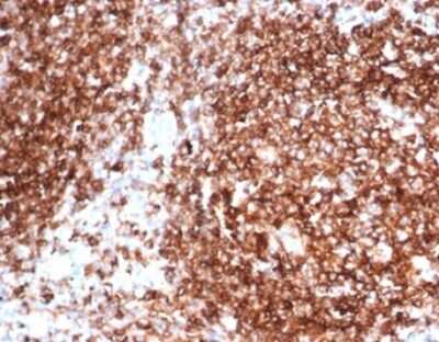 HLA DQ/DR/DP Antibody (HLA-Pan/6663) - Azide and BSA Free Immunohistochemistry-Paraffin: HLA DQ/DR/DP Antibody (HLA-Pan/6663) - Azide and BSA Free [NBP3-14091] -