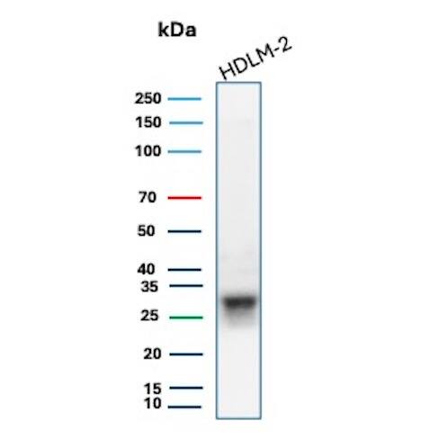 HLA DQ/DR/DP Antibody (HLA-Pan/6663) - Azide and BSA Free Western Blot: HLA DQ/DR/DP Antibody (HLA-Pan/6663) - Azide and BSA Free [NBP3-14091] -