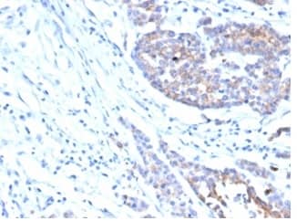IGF-I R/IGF1R Antibody (IGF1R/4667) - Azide and BSA Free Immunohistochemistry-Paraffin: IGF-I R/IGF1R Antibody (IGF1R/4667) - Azide and BSA Free [NBP3-14094] -