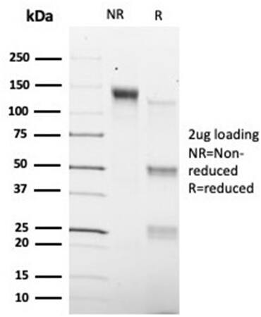 Smad9 Antibody (PCRP-SMAD9-2F4) - Azide and BSA Free Immunocytochemistry/ Immunofluorescence: Smad9 Antibody (PCRP-SMAD9-2F4) - Azide and BSA Free [NBP3-14117] -