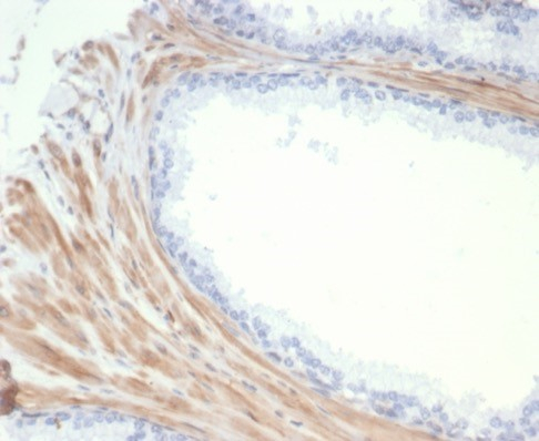 Phosphoglucomutase 5 Antibody (PGM5/7005R) - Azide and BSA Free