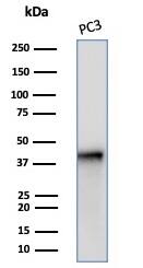 Serpin B5/Maspin Antibody (SERPINB5/4972) - Azide and BSA Free Western Blot: Serpin B5/Maspin Antibody (SERPINB5/4972) - Azide and BSA Free [NBP3-14135] -