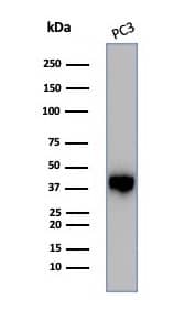 Serpin B5/Maspin Antibody (SERPINB5/4975) - Azide and BSA Free Western Blot: Serpin B5/Maspin Antibody (SERPINB5/4975) - Azide and BSA Free [NBP3-14136] -