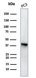 Serpin B5/Maspin Antibody (SERPINB5/4977) - Azide and BSA Free Western Blot: Serpin B5/Maspin Antibody (SERPINB5/4977) - Azide and BSA Free [NBP3-14137] -