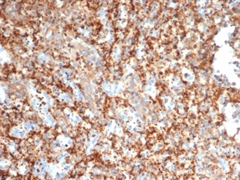 PI 3-Kinase p85 beta Antibody (PIK3R2/292) - Azide and BSA Free