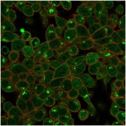 ZSCAN2 Antibody (PCRP-ZSCAN2-1F8) - Azide and BSA Free Immunocytochemistry/ Immunofluorescence: ZSCAN2 Antibody (PCRP-ZSCAN2-1F8) - Azide and BSA Free [NBP3-14151] -