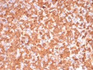 PKC iota Antibody (PRKCI/4911) - Azide and BSA Free Immunohistochemistry-Paraffin: PKC iota Antibody (PRKCI/4911) - Azide and BSA Free [NBP3-14155] -