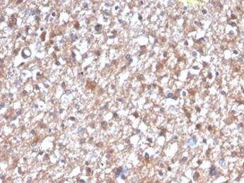 PKC iota Antibody (PRKCI/4912) - Azide and BSA Free Immunohistochemistry-Paraffin: PKC iota Antibody (PRKCI/4912) - Azide and BSA Free [NBP3-14156] -