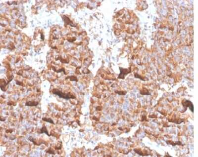 Prolactin Antibody (PRL/4906R) - Azide and BSA Free Immunohistochemistry-Paraffin: Prolactin Antibody (PRL/4906R) - Azide and BSA Free [NBP3-14158] -