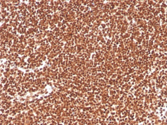 RPA2 Antibody (RPA2/4774) - Azide and BSA Free