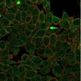 ZNF704 Antibody (PCRP-ZNF704-3C10) - Azide and BSA Free Immunocytochemistry/ Immunofluorescence: ZNF704 Antibody (PCRP-ZNF704-3C10) - Azide and BSA Free [NBP3-14168] -