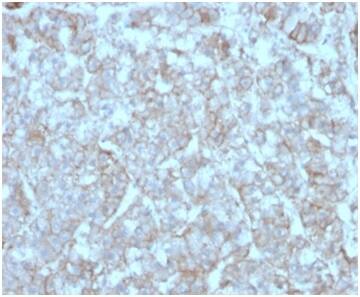 CCL8/MCP-2 Antibody (CCL8/3312) - Azide and BSA Free Immunohistochemistry-Paraffin: CCL8/MCP-2 Antibody (CCL8/3312) - Azide and BSA Free [NBP3-14172] -