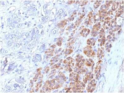 IL-17E/IL-25 Antibody (IL25/625) - Azide and BSA Free Immunohistochemistry-Paraffin: IL-17E/IL-25 Antibody (IL25/625) - Azide and BSA Free [NBP3-14176] -