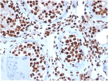 SNF5 Antibody (SMARCB1/3984) - Azide and BSA Free Immunohistochemistry-Paraffin: SNF5 Antibody (SMARCB1/3984) - Azide and BSA Free [NBP3-14177] -