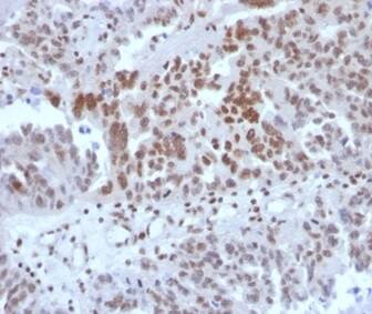 SP100 Antibody (PCRP-SP100-1B9) - Azide and BSA Free Immunohistochemistry-Paraffin: SP100 Antibody (PCRP-SP100-1B9) - Azide and BSA Free [NBP3-14183] -