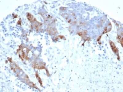 Transglutaminase 2/TGM2 Antibody (TGM2/6943R) - Azide and BSA Free Immunohistochemistry-Paraffin: Transglutaminase 2/TGM2 Antibody (TGM2/6943R) - Azide and BSA Free [NBP3-14193] -