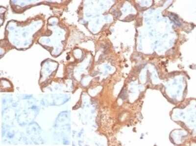 Transglutaminase 2/TGM2 Antibody (TGM2/6943R) - Azide and BSA Free Immunohistochemistry-Paraffin: Transglutaminase 2/TGM2 Antibody (TGM2/6943R) - Azide and BSA Free [NBP3-14193] -