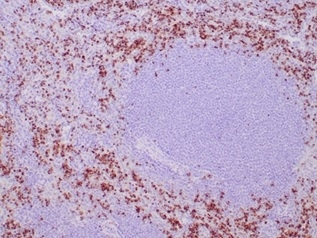 TIA1 Antibody (TIA1/1352R) - Azide and BSA Free